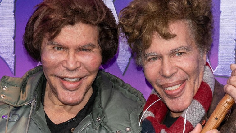 The Bogdanoff Twins - French “Plastic Surgery” Entertainers Die Within A Week Of Each Other  