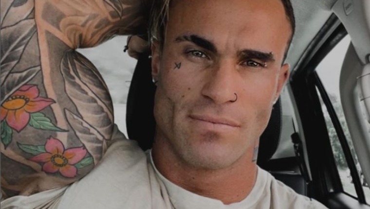 Bodybuilder Calum Von Moger Says "It's Nice To Be Alive" After Near-Fatal Fall - Shares Brutal Photos Of The Aftermath