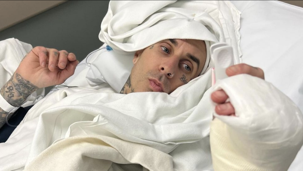 Travis Barker Updates His Fans Following Finger Operation